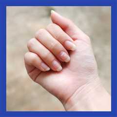 Soothe Your Pet’s Upset Tummy With Hill’s Prescription Diet GI Biome