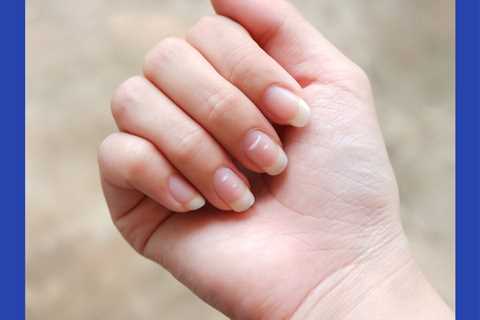 Soothe Your Pet’s Upset Tummy With Hill’s Prescription Diet GI Biome